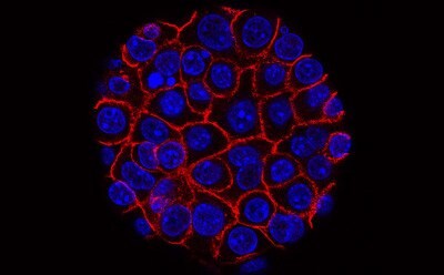 Flourescent cell cluster