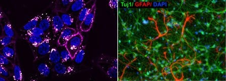 Live Cell Imaging Analysis