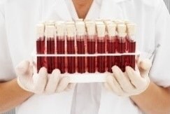 A healthcare professional with gloved hands holding a rack of blood samples in test tubes.