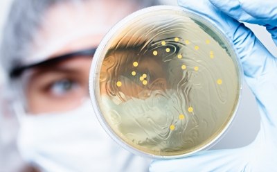 Scientist observing petri dish with bacterial colonies