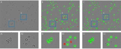 Improvement of the artificial intelligence algorithm of the Corning Cell Counter. A) unprocessed image. B) Results of the old algorithm, many cells in clusters are not detected properly and debris is wrongly detected as dead cells. C) Results of the new algorithm, all individual cells within clusters are detected properly and no debris is detected as dead cells. Ai-Cii) Zoomed in images of blue boxes containing examples of the improved individual cell detection (i) and dead cell detection (ii).