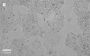 Brightfield imaging of Huh-7D12 cells on Millicell<sup>®</sup> DCI Digital Cell Imager at 20X magnification