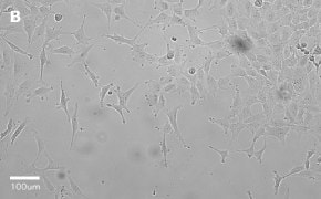 Brightfield imaging of MRC-5 SV2 cells on Millicell<sup>®</sup> DCI Digital Cell Imager at 20X magnification