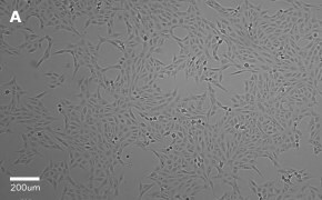 Brightfield imaging of Vero cells on Millicell<sup>®</sup> DCI Digital Cell Imager at 10X magnification