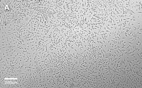 Brightfield imaging of L929 cells on Millicell<sup>®</sup> DCI Digital Cell Imager at 10X magnification