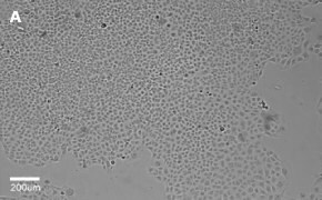 Brightfield imaging of C1008 cells on Millicell<sup>®</sup> DCI Digital Cell Imager at 10X magnification