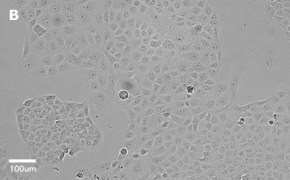 Brightfield imaging of T24T cells on Millicell<sup>®</sup> DCI Digital Cell Imager at 20X magnification