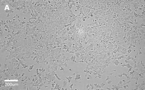 Brightfield imaging of MCF-7 cells on Millicell<sup>®</sup> DCI Digital Cell Imager at 10X magnification