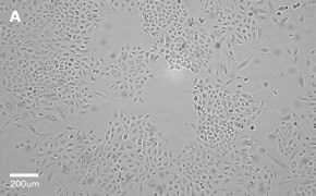 Brightfield imaging of A549 cells on Millicell<sup>®</sup> DCI Digital Cell Imager at 10X magnification