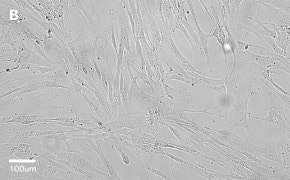 Brightfield imaging of WI38 cells on Millicell<sup>®</sup> DCI Digital Cell Imager at 20X magnification