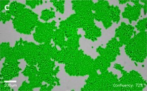 Brightfield imaging of HCT116 cells on Millicell<sup>®</sup> DCI Digital Cell Imager at 10X magnification with mask