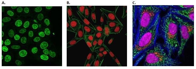 Live cell imaging of the cellular nucleus