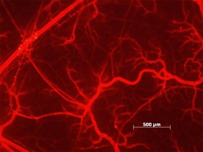 TRITC-dextran 150 injected in a hamster cheek pounch 15min after histamine challenge. (by kind permission of E.Svensjö).