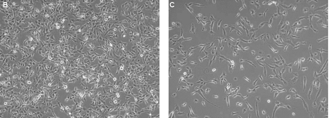 Morphology of HT1080 fibrosarcoma cells cultured in Cancer Cell Line Medium XF compared toconventional FBS containing culture conditions