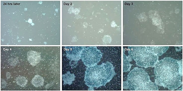 Time course of pluripotent stem cell expansion in PluriSTEM™ media