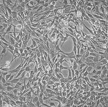 Stromal Cells for T-Cell Differentiation