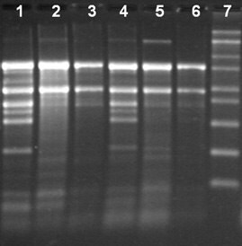 Total RNA Isolation from different tissue types of tobacco using the Spectrum™ Total RNA kit