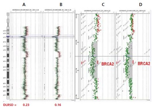 CGH Analytics views of Agilent 244K analyses (5) of a human frozen breast tumor vs. normal female