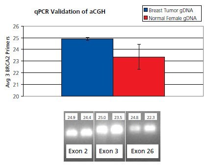 Validation of aCGH breast cancer data using BRCA2 gene-specific quantitative PCR