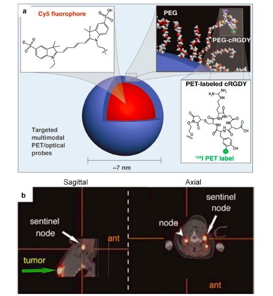 Multimodal silica nanoparticles for targeted cancer diagnosis in a model of human melanoma.