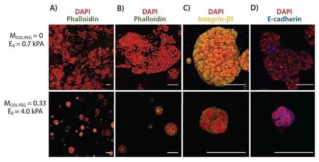 Effects of hydrogel elastic modulus