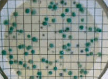 Figure 2 CP ChromoSelect Agar (C. perfringens appears as green colonies)