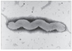 Electron micrograph of Campylobacter jejuni (Gaynor et al. 2004)