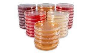A collection of Petri dishes in various colors, including shades of red, orange, and clear, stacked and arranged in a circular formation against a white background.
