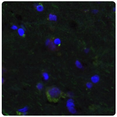 Multiplexed IHC-IF staining of human normal cortex samples using Anti-SALL4 monoclonal (Product No. AMAb91769) and Anti-PTEN monoclonal (Product No. AMAb91736) antibodies.