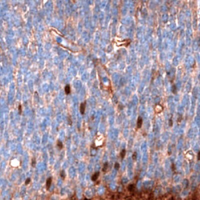 Immunohistochemical staining of developing brain cells in mouse embryo E11 using Anti-SALL4 monoclonal antibody (Product No. AMAb91769) showing nuclear positivity.