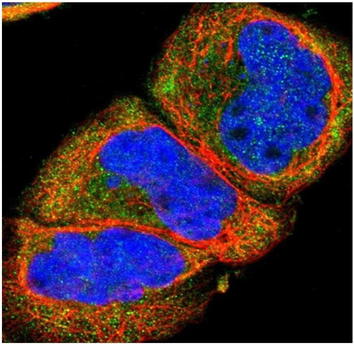 Immunofluorescent staining of human cell line A-431 with anti-SSTR2 polyclonal antibody (Cat. No. HPA007264) shows localization to cytosol, in green. Microtubules are shown in red and nuclei in blue.