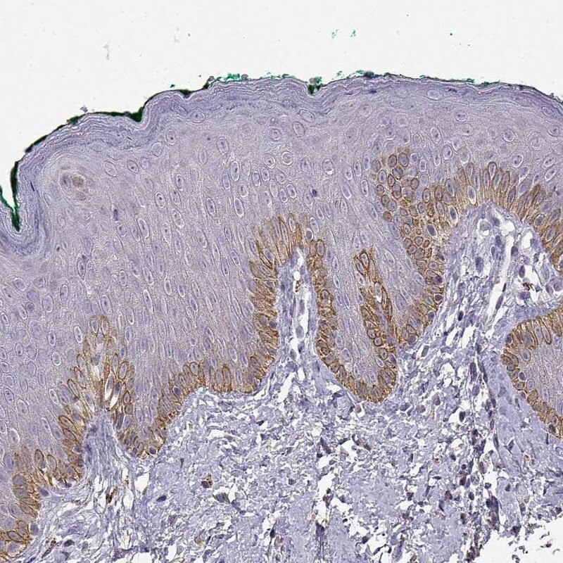 Immunohistochemical staining of human skin with anti-TACR1 polyclonal antibody (Cat. No. HPA074573) shows strong cytoplasmic positivity in epidermal cells in the basal layer.