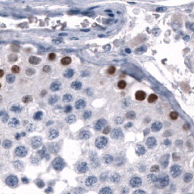 Immunohistochemical staining of human germinal cells in testis using Anti-SALL4 monoclonal antibody (Product No. AMAb91769) showing nuclear positivity