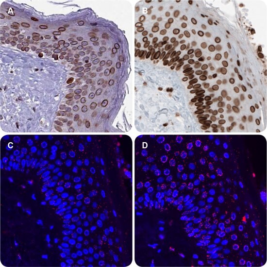 IHC staining with the Anti-EMD antibody AMAb90560