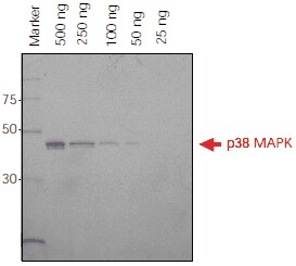 Direct Detection of Histidine-Tagged Proteins on SDS-PAGE Gels