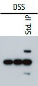 In a cross-linking IP western, the heavy and light chains of the primary capture antibody are excluded from the sample.