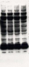 High background, leading to nonspecific bands on Western blot