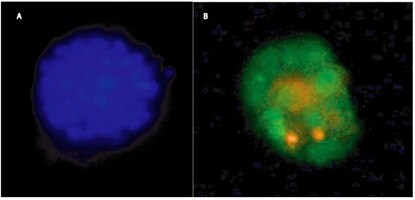 3-D Culture of MCF-10A Breast Cancer Cells using 3-D Culture Matrix™ Laminin I for 15 days in the presence of 2% Liminin I in Assay Medium, and stained using A) CPA Dye 2, and B) SYBR® Green (nuclear) and propidium iodine (dead or necrotic).