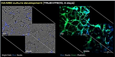 Microscopy images of human adipose MSCs cultured in 3D using TrueGel3D HTS hydrogel plates. Keywords: MSC, mesenchymal stem cells, truegel3d