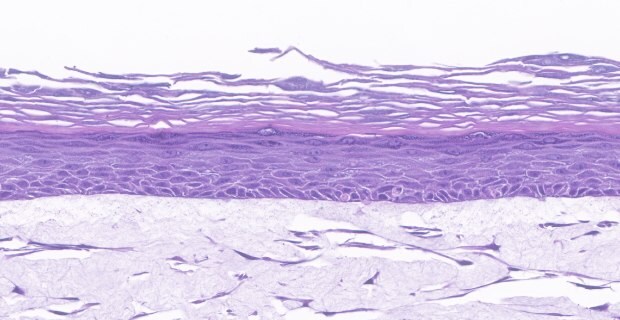 Organotypic skin models contain actively proliferating keratinocytes. (B)