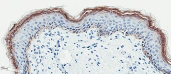 <b>D</b>. Neonatal Skin Tissue