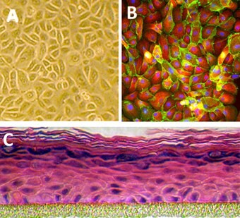 Human Epidermal Keratinocytes