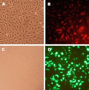 Human Coronary Artery Endothelial Cells (HCAEC)