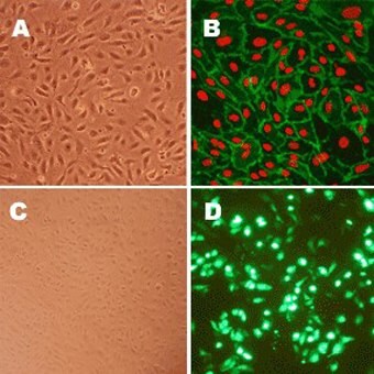 Human Aortic Endothelial Cells (HAOEC)