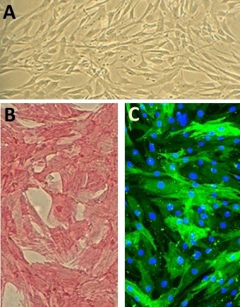 Human Aortic Smooth Muscle Cells (HAOSMC)