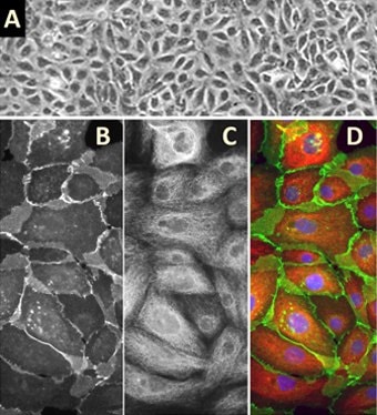 Human Mammary Epithelial Cells (HMEpC)