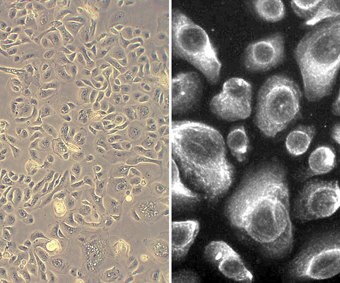 Human Bronchial Epithelial Cells (HBEpC)