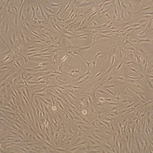 Human Fibroblast-Like Synoviocytes (HFLS)