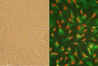 Human Cardiac Fibroblasts