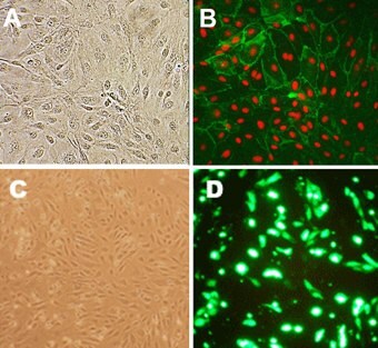 human lung microvascular